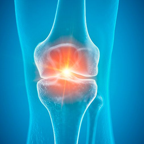 KNEFIKSER: I fremtiden kan slitasjeskader i knær kanskje fikses med genterapi eller ved å dyrke opp ny brusk fra dine egne stamceller. Foto: NTB Scanpix.